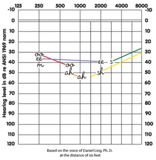 Hearing Level Graph Hearing Level Graph